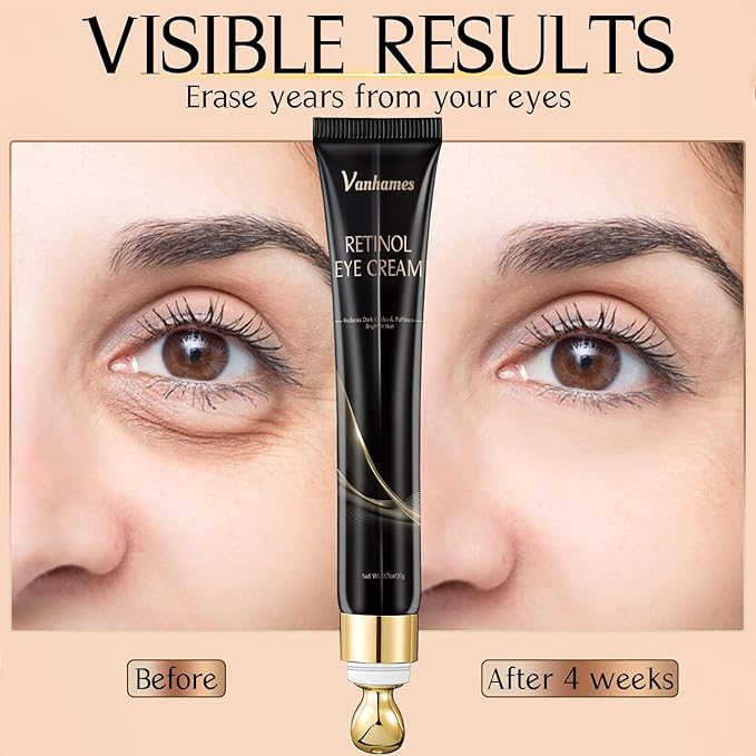 Retinol Caffeine Eye Cream, Under Eye Cream for Dark Circles and Puffiness, Anti Aging Eye Cream for Wrinkles, Eye Bags Treatment for Men and Women, 20g (Fragrance Free)-VivaGrace Women