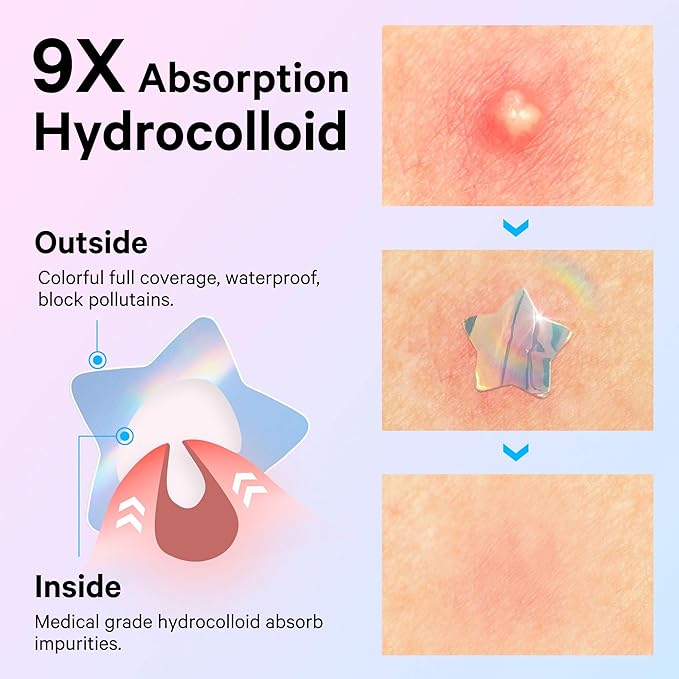 Sosky Hologram Pimple Patches for Face, Hydrocolloid Acne Patches with Salicylic Acid, Cute Star Zit Stickers,Colorful Blemish Covers,48 Count Blue Pink Heart Moon Butterfly Flower