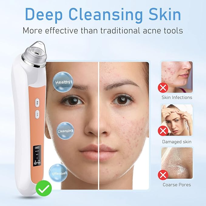 Facial Pore Blackhead Remover Vacuum, 1080P Camera Blackhead Remover, 20x Zoom, 8 LEDs & 3 Suction Modes, 800mAh Battery & USB - 6 Heads Pore Cleaner Kit for Women&Men(Orange)