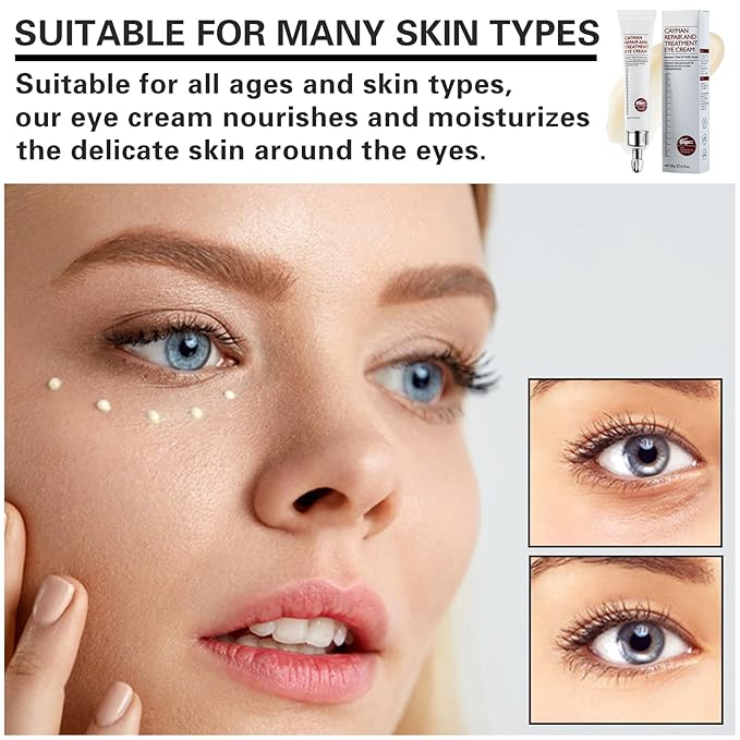 Eye Cream for Dark Circles Bags Eye Cream Eye Products Under Eye Bags Dark Circles-VivaGrace Women