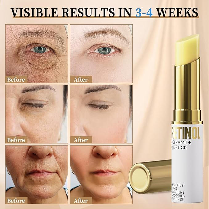 Retinol Eye Stick, Eye Cream for Dark Circles and Puffiness, Hydration and Brightening Eye Balm, Under Eye Cream Anti Aging Visible Results in 3-4 Weeks Reduces Fine Lines Bags-VivaGrace Women