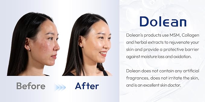 Relaxing Mist Facial Spray With Msm And Collagen, Face Mist Hydrating And Redness Remedy,No Artificial Fragrance, Body/Skin Care, 4 Fl Oz-VivaGrace Women