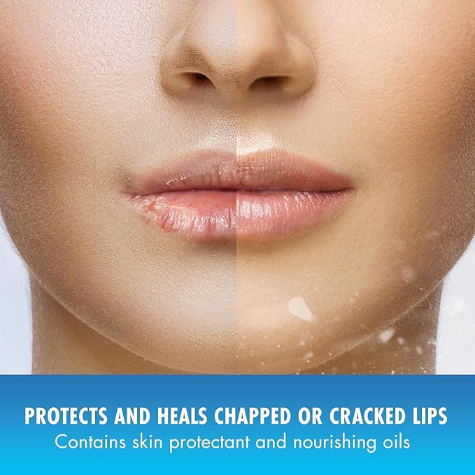 Natural Ice Medicated Lip Protect SPF 15 Cherry 12 Pkgs-VivaGrace Women