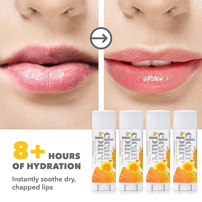 Lip Balm Singles (Manuka Honey with Sunscreen) 100% Natural Beeswax, Vitamin E Oil | Olive Oil Based Treatment for Dry, Chapped Lips | Made in Australia…-VivaGrace Women
