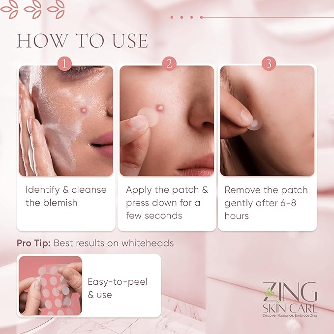 Prime Patch - Hydrocolloid Pimple Patches for Face, Clear Zit Stickers & Acne Dots, Strong Adhesion, Ultimate Blemish & Acne Patch, Made in Korea, Vegan (75 Count)