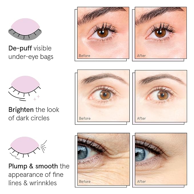 grace & stella Under Eye Patches (12 pairs) Eye Masks for Dark Circles and Puffiness - Birthday Gifts for Women, Bachelorette Party Favors, Bridesmaid Proposal Gifts, Self Care, Spa, Relaxation, Vegan-VivaGrace Women