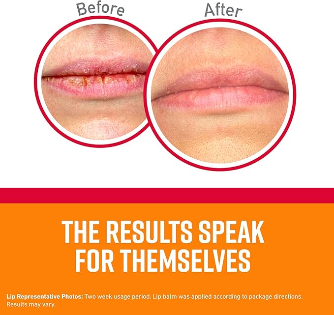 O'Keeffe's Medicated Lip Repair Seal & Heal Lip Protectant, Stick, (Pack of 2)-VivaGrace Women
