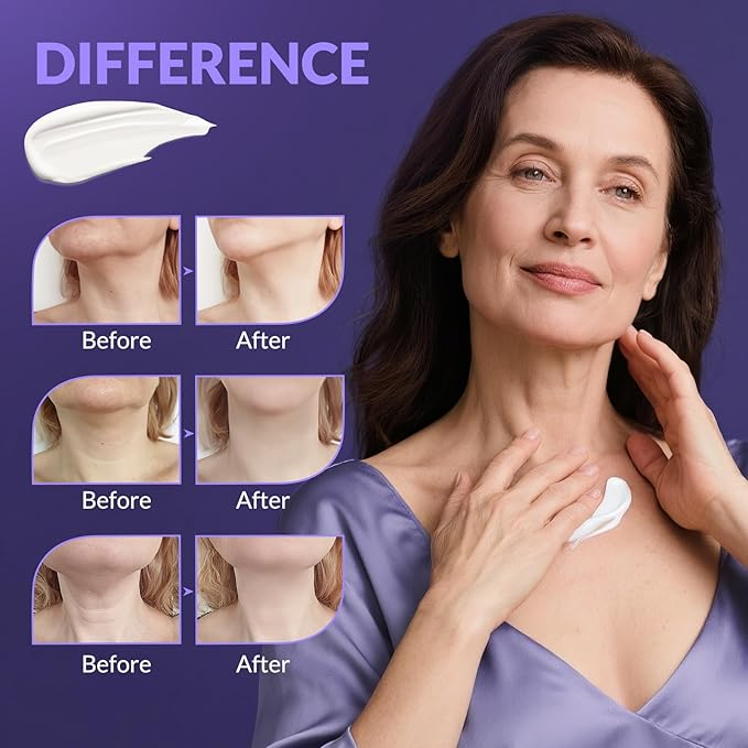 Neck Firming Cream, Wrinkle Cream for Women, Retinol Moisturizer with Collagen and Hyaluronic Acid for Neck, Face and Décolleté, 1.76 fl oz-VivaGrace Women