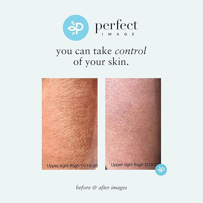 Perfect Image Gly + Sal Exfoliating Body Lotion, 8% Glycolic Acid and 2% Salicylic Acid Lotion Enhanced with Green Tea, Papaya, Bearberry, Licorice and Amino Complex-VivaGrace Women