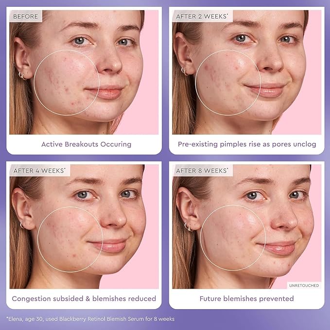 Glow Recipe Glass Skin Hydration Travel Size Korean Skincare Set - Includes Mini Cloudberry Facial Toner, Strawberry Blur Drops, Blackberry Retinol Serum & Pink Juice Moisturizer (4 Count)-VivaGrace Women