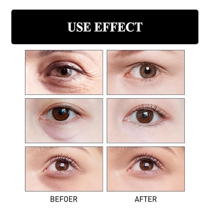 Retinol Snake Venom Peptide Eye Cream, Firming Eye Cream, Anti Ageing Eye Cream, Under Eye Cream For Puffiness and Bags Reduces Fine Lines-VivaGrace Women