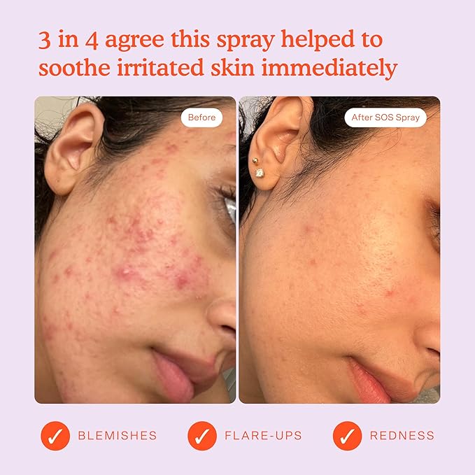 Tower 28 SOS Daily Rescue Facial Spray for Sensitive Skin, Hypochlorous Acid Spray Helps Reduce Redness and Breakouts, Full Size Toner for Face, 4 FL Oz-VivaGrace Women