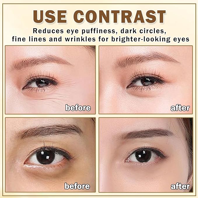 Eye Cream for Dark Circles Puffiness and Bags Eye Serum Eye Roller for Puffy Eyes Under Eye Cream for for Women Daily Skincare Crema Para Las Ojeras-VivaGrace Women