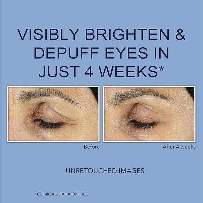 Retinol Polypeptide Eye Cream,Retinol Eye Cream for Dark Circles and Puffiness, Visible Results in 3-4 Weeks, Under Eye Cream for Anti Aging, for Puffiness and Bags to Reduce Fine Lines(2pcs)-VivaGrace Women