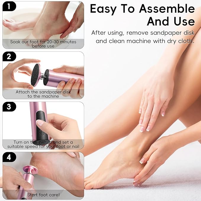 Electric Callus Remover,CHNYNJN Foot File Grinder Tool with Speed Controller and 20pcs Replacement Sandpaper and 10 Sand Rings Disk for Men Women Dead Dry Crack Skin Calluses-VivaGrace Women