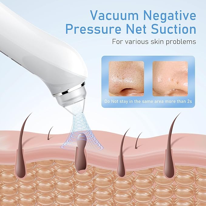 Facial Pore Blackhead Remover Vacuum, 1080P Camera Blackhead Remover, 20x Zoom, 8 LEDs & 3 Suction Modes, 800mAh Battery & USB - 6 Heads Pore Cleaner Kit for Women&Men(Green)
