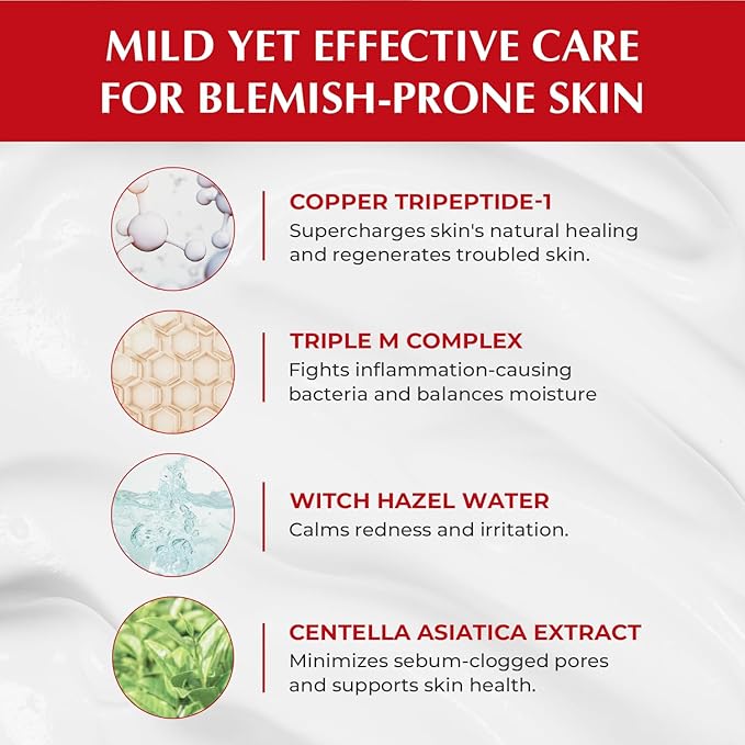 JEU'DEMEURE Korean skin care Acne Control Treatment Lotion for Sensitive Skin, Pimple Breakout, Peptide, Calming, Blemish Acne 2.53 fl oz