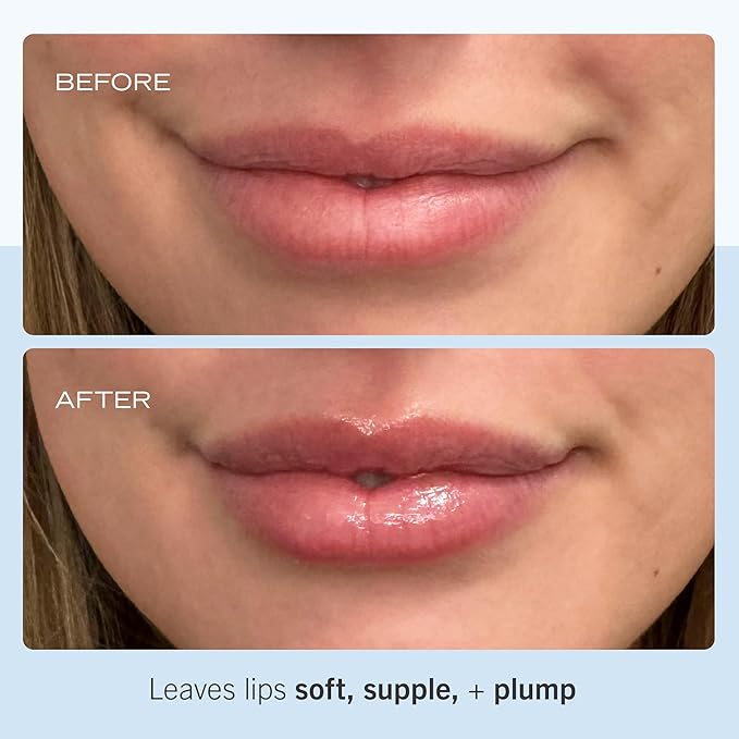 First Aid Beauty Ultra Repair Lip Balm – Instantly Hydrates to Leave Lips Soft, Supple + Plump – Concentrated Formula of Botanical Oils, Butters + Waxes – Three Pack, 3 * 0.25 oz-VivaGrace Women