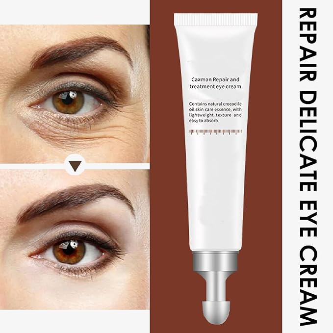 Eye Cream, STCORPS7 Vibrant Glamour Silk Protein Anti-Wrinkle And Firming Eye Cream For Wrinkles, Fine Lines, Dark Circles, Puffiness & Bags, 20g-VivaGrace Women