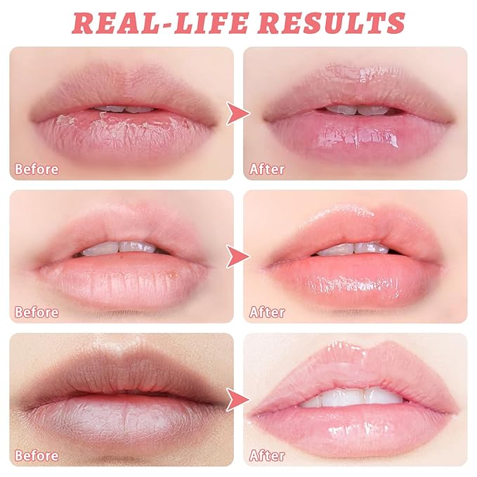 3 PCS Bee Lip Balm Honey Pot, Honey & Strawberry & Watermelon Lip Mask Overnight Propolis Moisturizing Lip Balm Hydrating Prevention Dry and Crack Lip Scrubs Exfoliator Lip Wrinkle Care (Set B)-VivaGrace Women