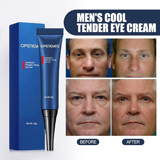 AKARY Awaken Peptide Depuffing Eye Gel, OPENEYES Lifts Firming Eye Tightener, Men's Moisturizing Eye Cream Hydrating Eye Gel Smooths Under Eyes for Dark Circles, Puffiness, Fine Lines, and Bags-VivaGrace Women