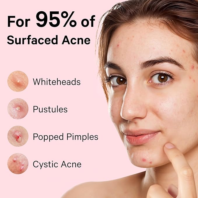 Sosky Pimple Patches for Face, FSA HSA Eligible Invisible Hydrocolloid Acne Patches, Zit Sticker for Face and Skin, Pimple Sticker for Covering Zits, Blemishes with Salicylic Acid 96 Count