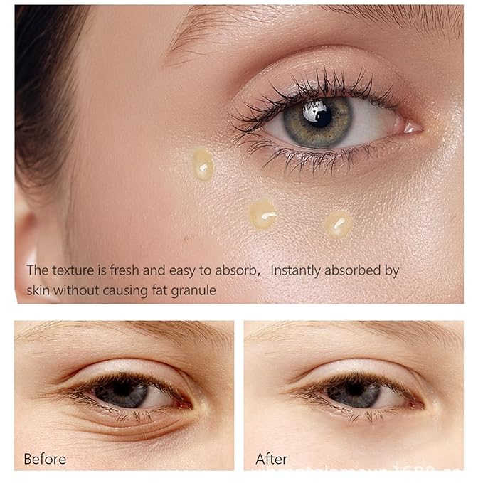 Retinol Eye Serum Anti Aging Under Eye Cream Visibly Reduces Wrinkles Fine Lines in 4-8 Weeks - Tightening Firming with Double Retinol 30ml-VivaGrace Women