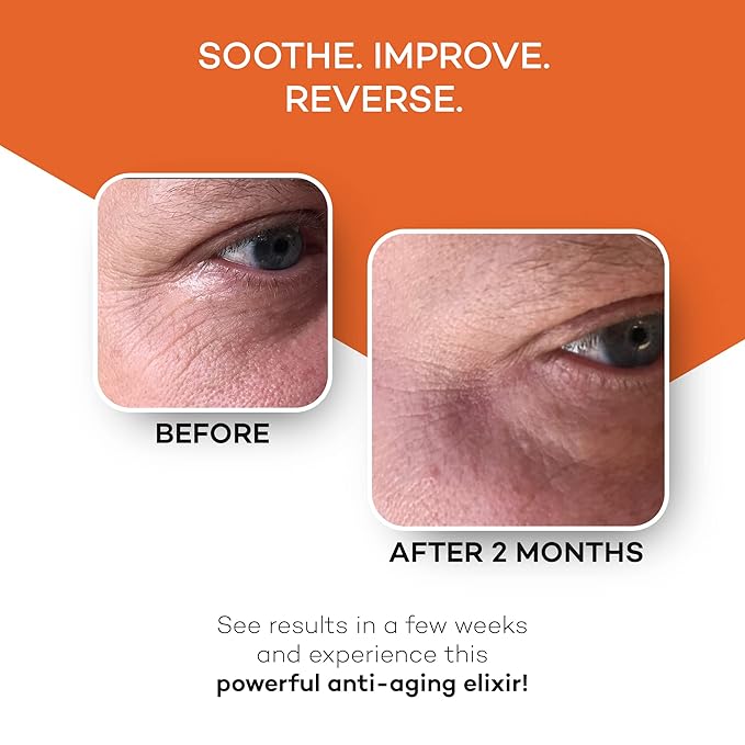 Zocufill Elixir Eye Gel and Face Serum - Eye Bags Treatment for Women and Men - Reduce the Appearance of Dark Circles, Puffy Eyes, Fine Lines and Wrinkles-VivaGrace Women