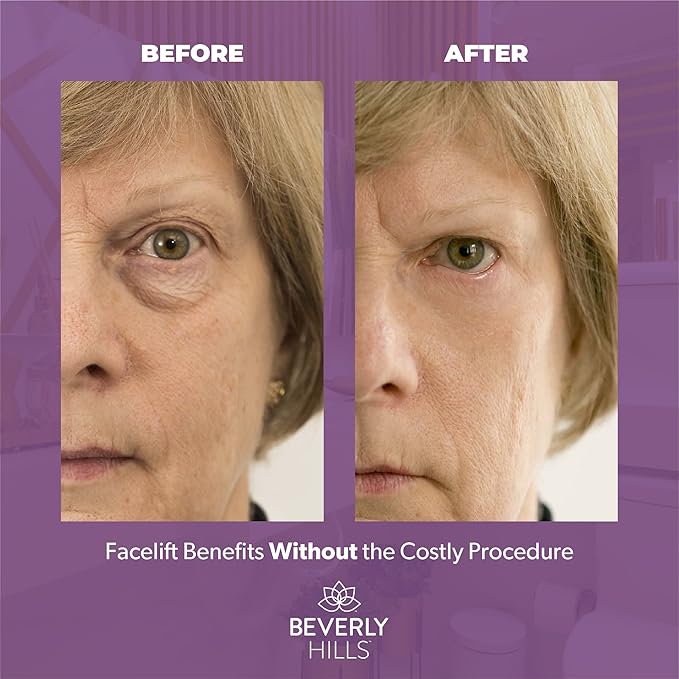 Beverly Hills V-Lift Instant Eye Lift and Eye Tuck Bee Venom Serum for Puffy Eyes, Dark Circles, Wrinkles, and Under Eye Bags Treatment for Women and Men | 30mL (120 Day Supply)-VivaGrace Women