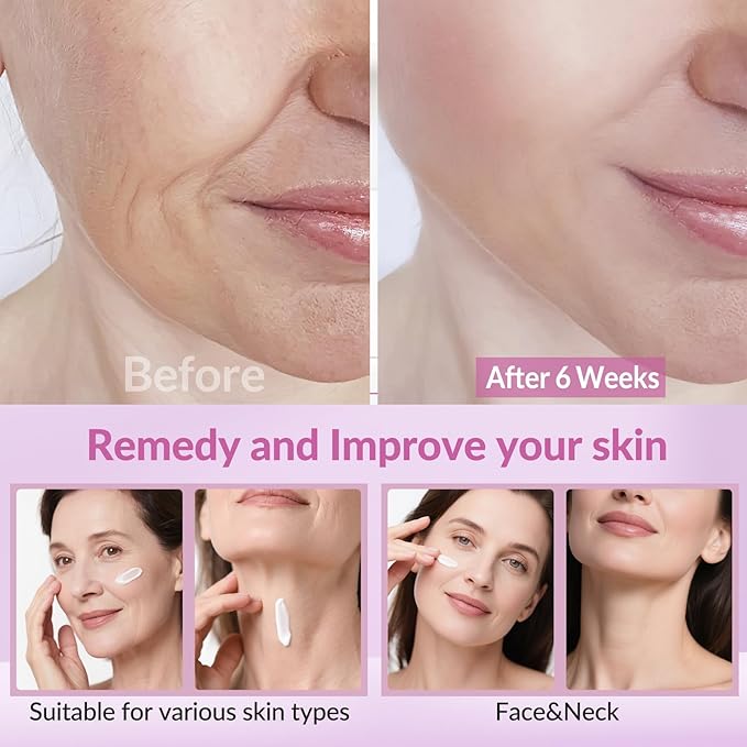 Neck Firming Creams for Tightening and Firming, Moisturizer Face Cream with Collagen, Hyaluronic Acid, Day & Night Anti-Aging Skin Tightening Cream Neck, Décolleté & Face – 1.7Fl Oz-VivaGrace Women