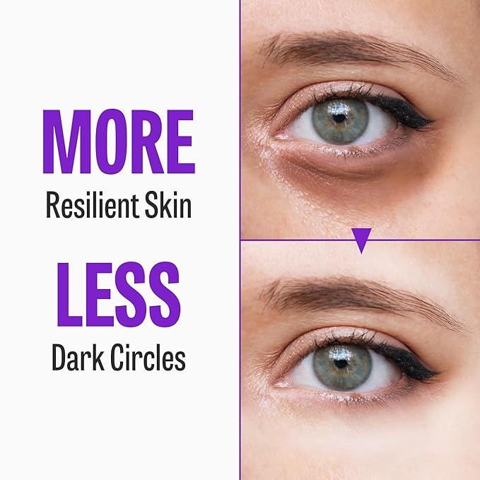 Time Return Melatonin Eye Cream for Dark Circles & Fine Lines | Clarifying Eye Cream for Bags Under Eyes | Firming Eye Cream for Fine Lines| Moisturizing Eye Cream for Eye Care (0.70 oz)-VivaGrace Women