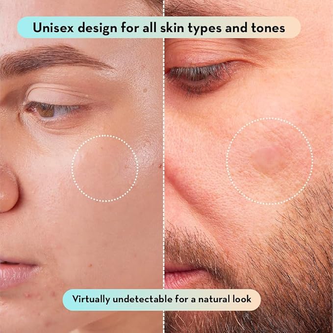 LE GUSHE Korean Pimple Patches for Face (78 Dots) - Hydrocolloid Acne Patches with Tea Tree Oil - Invisible Zit Stickers - Dermatologist Tested - Korean Skin Care