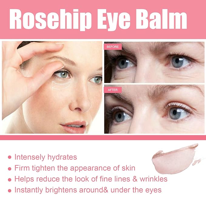 Rosehip Eye Cream Stick, Moisturizing, Hydrating, Lightens Lines and Dark Circles, Lifting, Firming-VivaGrace Women