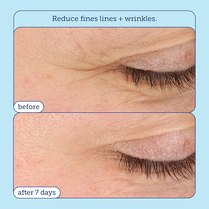 Skinfix Barrier+ Triple Lipid-Boost 360° Eye Cream: Targets Dark Circles, Puffiness, and Fine Lines Around Eyes and Lids, Clinically Proven to Brighten and Refresh Eyes, 0.5 oz-VivaGrace Women