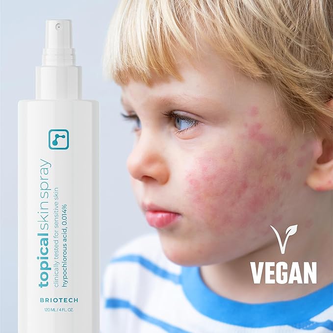 BRIOTECH Topical Skin Spray, Hypochlorous Acid for Sensitive Skin, HOCl Facial Mist, Full Body Support Against Irritation, Calm Redness, Soothe Foot & Scalp, 32 oz Refill (1 Pack)-VivaGrace Women