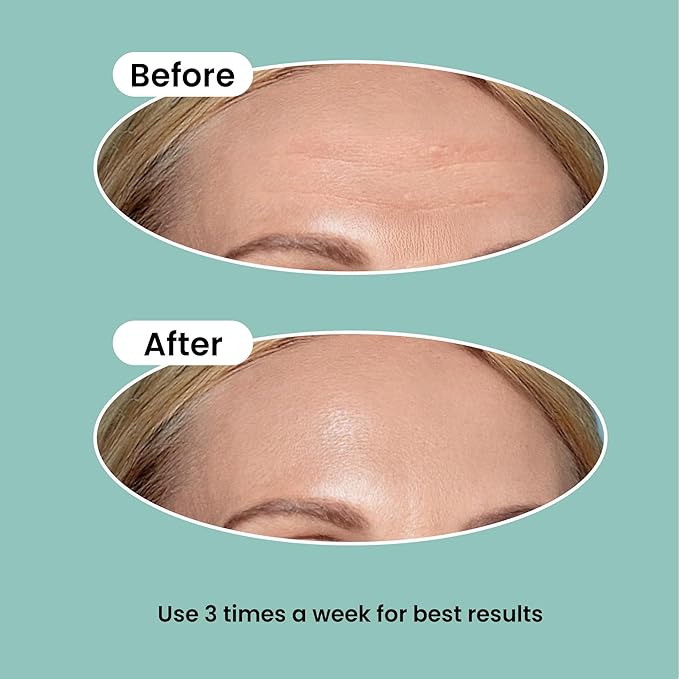 Advanced Wrinkle Patches 60ct Smile Line, Frown Line Wrinkle Patches for Facial Korean Skin Care Face Wrinkle Tape Invisible Overnight with Retinol & Collagen (Large (Forehead))-VivaGrace Women