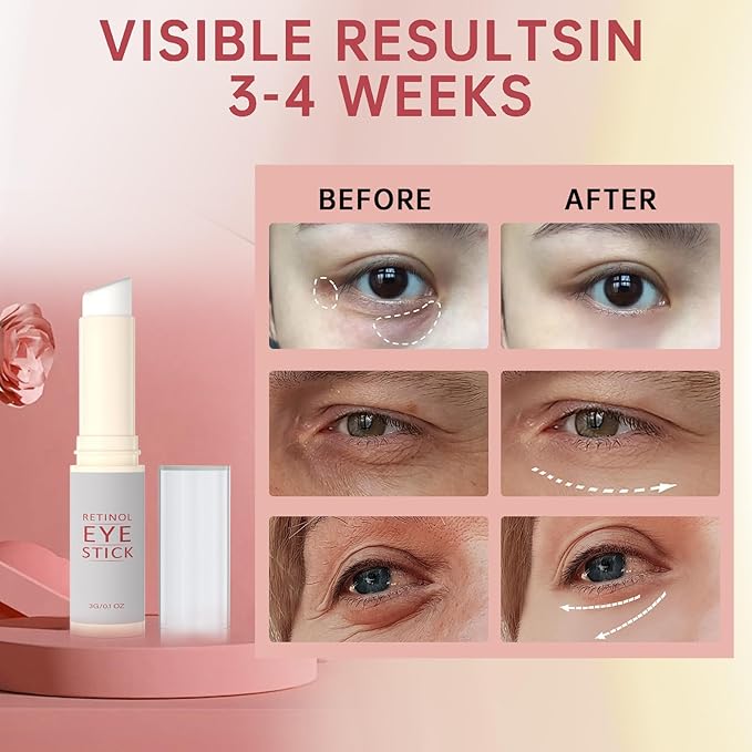 2Pcs Retinol Eye Stick, Retinol Under Eye Cream for Puffiness and Dark Circles, Hydrating Eye Cream Anti Aging for Enhanced Under Eye Nourishment.-VivaGrace Women
