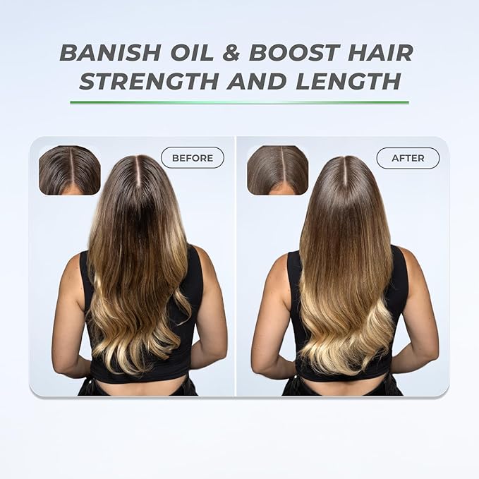 XMONDO Hair BOOST X Dry Shampoo, Zero Residue, Formulated with Saw Palmetto to Promote Scalp Care, Clinically Tested, Dermatologist Tested, Talc-free, Benzene-free, Free of aluminum starch, 5 oz-VivaGrace Women