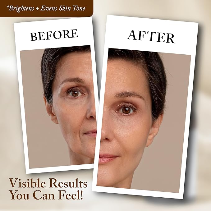 4 Oz Face Lift Mist - Hydrating Face Moisturizer with Green Tea & Niacinamide - Natural Skin Care Spray with Antioxidants, Amino Acids & Aloe for Brighter, Softer Complexion-VivaGrace Women