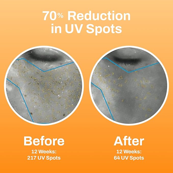 Photozyme DNA Youth Recovery Facial Serum | 0.5 Fl Oz-VivaGrace Women