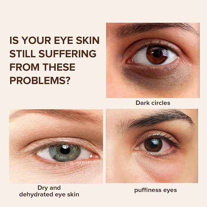 Caffeine Eye Cream for Dark Circles, Under Eye Treatment Eye Cream with Caffeine Anti Aging Wrinkles Lifting Firming Moisturizer Tightening Eye Cream 20ML-VivaGrace Women