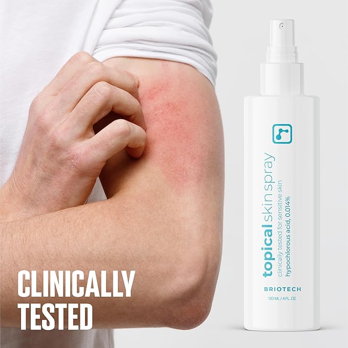 BRIOTECH Topical Skin Spray, Hypochlorous Acid Spray for Sensitive Skin, HOCl Facial Mist, Full Body Support Against Irritation, Calm Redness, Soothe Foot & Scalp, 4 oz-VivaGrace Women