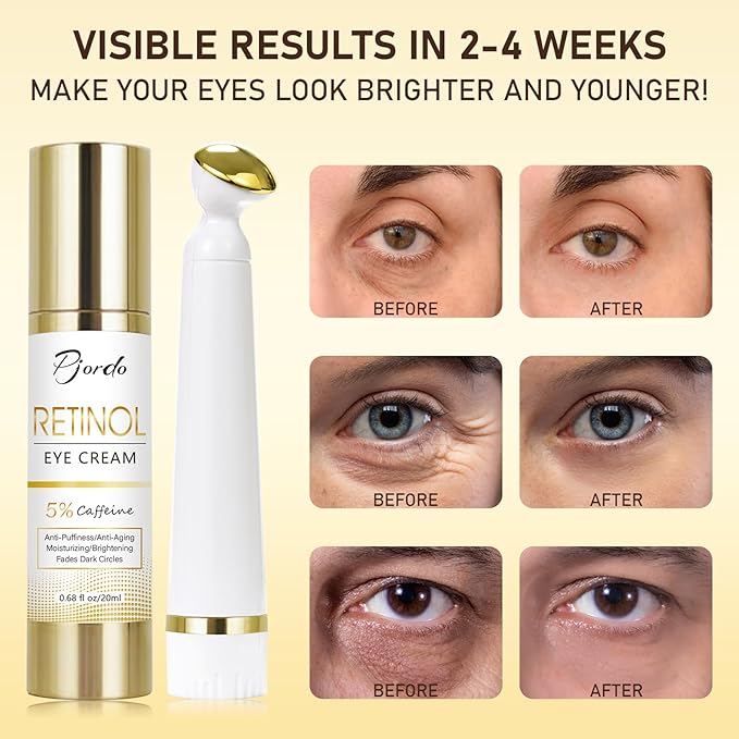 Retinol Eye Cream for Dark Circles Puffiness, Under Eye Cream Anti Aging Eye Cream Reduce Wrinkles & Fine Lines, 5% Caffeine Eye Cream with Eye Massage Wand, Perfect Gifts-VivaGrace Women