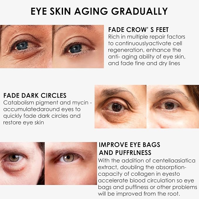 Eye Cream, STCORPS7 Vibrant Glamour Silk Protein Anti-Wrinkle And Firming Eye Cream For Wrinkles, Fine Lines, Dark Circles, Puffiness & Bags, 20g-VivaGrace Women