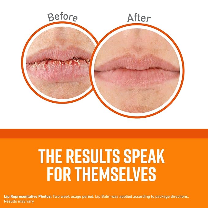 O'Keeffe's Unscented Lip Repair Lip Balm for Dry, Cracked Lips, Stick, (Pack of 8)-VivaGrace Women