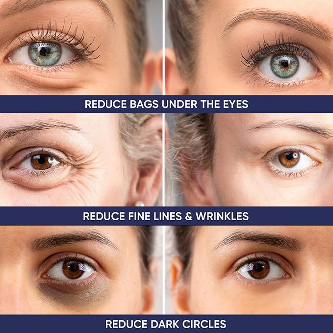 Instant Ageless Eye Cream – Anti Wrinkle Cream, Removes Under Eye Puffiness, Bags, Expression Lines, & Dark Circles. Powerfully Tighen & Lifts Sagging Skin. Disappears Before Your Eyes In Minutes.-VivaGrace Women