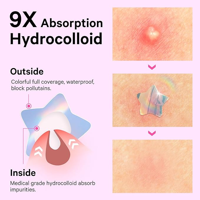 Sosky Hologram Pimple Patches for Face, Hydrocolloid Acne Patches with Salicylic Acid, Cute Star Zit Stickers,Colorful Blemish Covers,48 Count Pink Heart