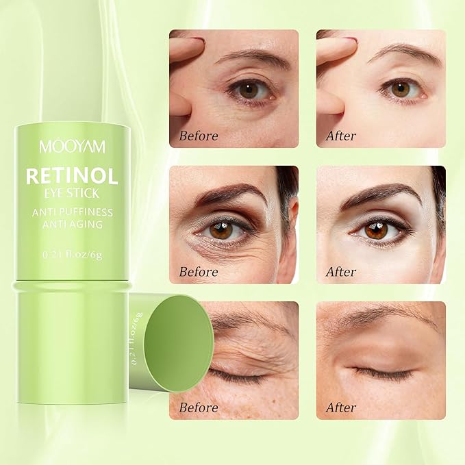 Retinol Eye Cream Brightening Eye Stick Anti-aging Eye Cream for Dark Circles and Puffiness Dark Circles Under Eye Treatment Under Eye Cream Puffy Eyes Treatment Firm Eye Bags Treatment for Men Women-VivaGrace Women