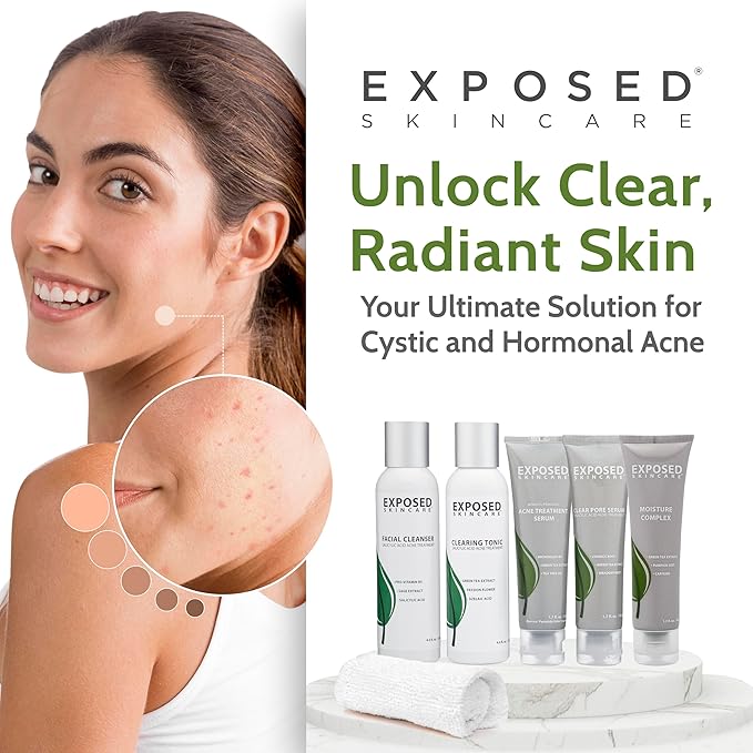 Exposed Skin Care Expanded Acne Treatment Kit - Includes Salicylic Acid Face Wash, Clearing Tonic, Treatment Serum with Benzoyl Peroxide, Clear Pore Serum, Moisture Complex - Made for All Skin Types-VivaGrace Women