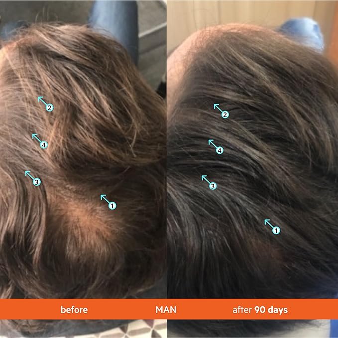 DS Labs Revita Shampoo and Conditioner – High-Performance Hair Density Shampoo & Conditioner, Volumizing & Thickening, Fuller, Healthier-Looking Hair, Sulfate & Silicone Free, For Men & Women, 205mL-VivaGrace Women